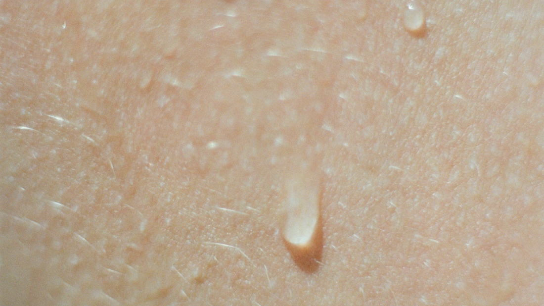 Close-up of a water droplet resting on human skin.