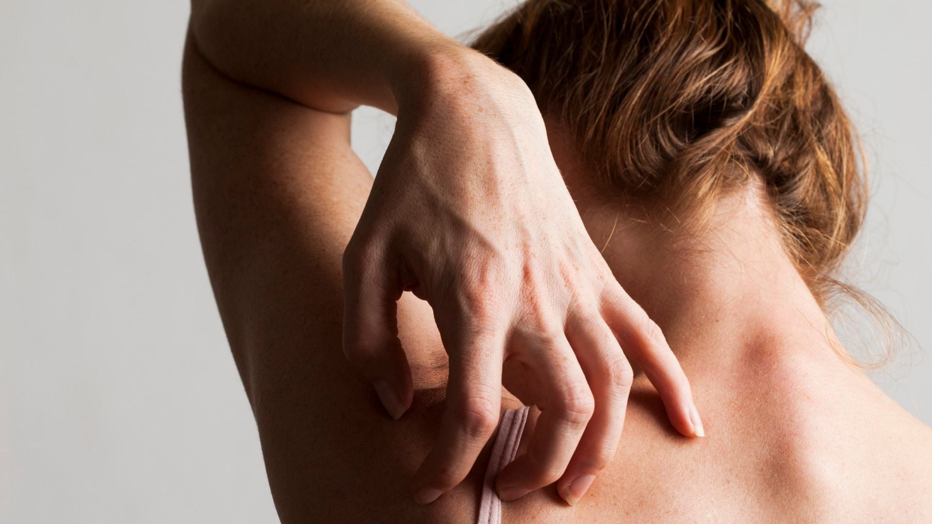 Woman scratching with sensitive skin