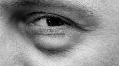 Why Do I Have Puffy Eyes in the Morning? Causes and Solutions