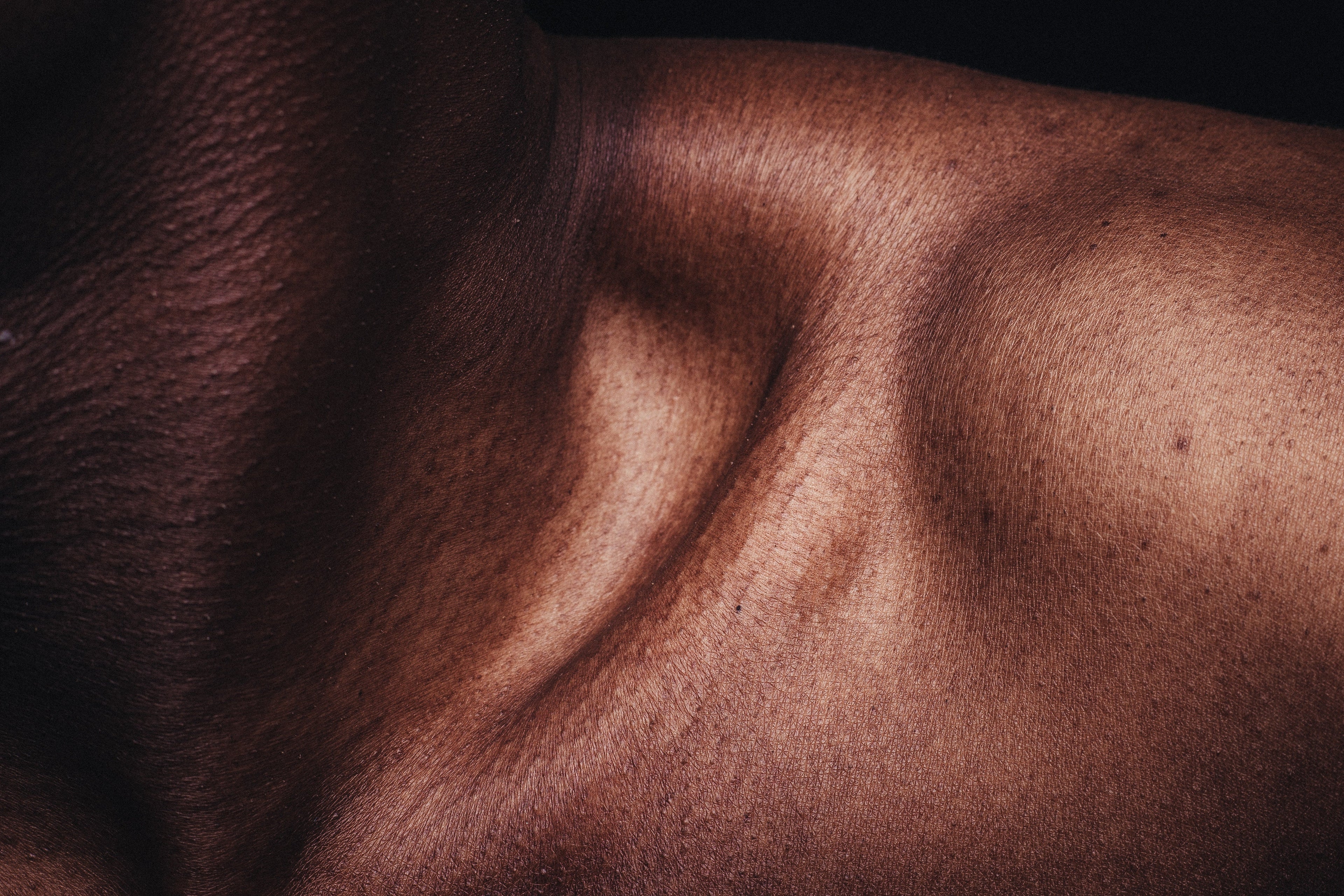 Close up of dark woman's dry skin